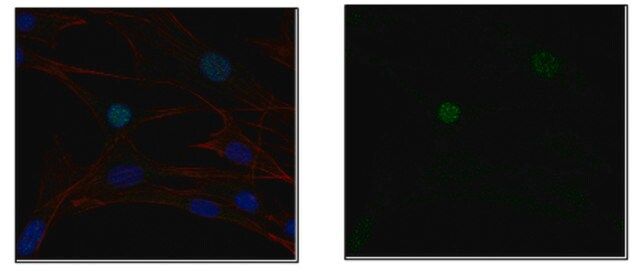 Anti-E3 ubiquitin-protein ligase UHRF1, clone BF18.11 Antibody