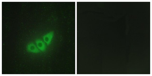 Anti-E2AK3 antibody produced in rabbit