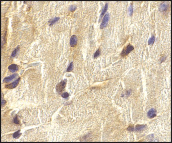 Anti-ECSIT antibody produced in rabbit