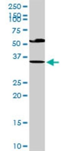 Anti-EDA2R antibody produced in rabbit