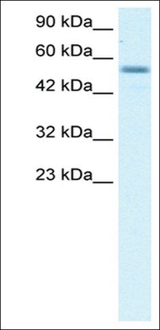 Anti-EBF3 antibody produced in rabbit