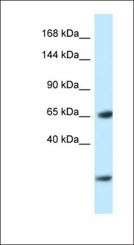 Anti-EBF3 antibody produced in rabbit