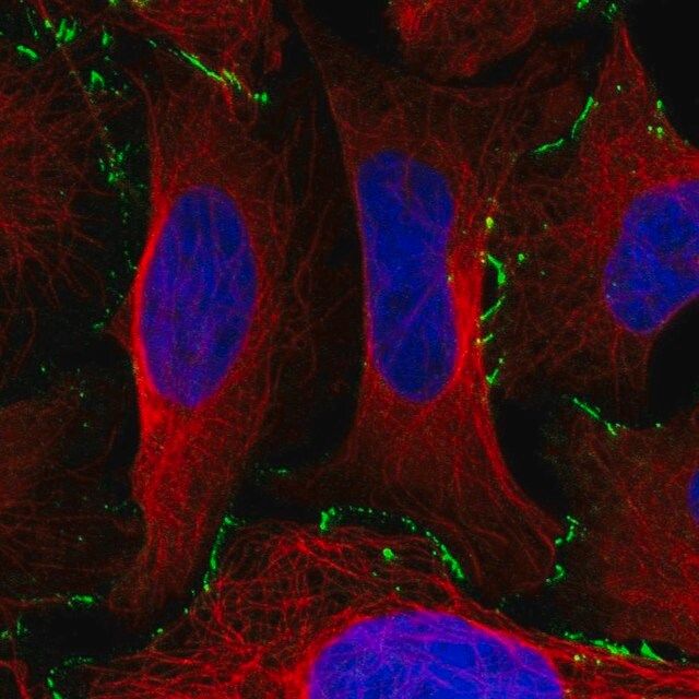 Anti-EDA2R antibody produced in rabbit