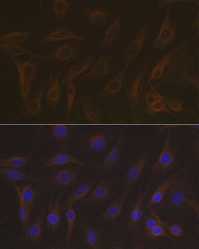 Anti-EB3/MAPRE3 antibody produced in rabbit