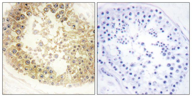 Anti-ECRG4 antibody produced in rabbit