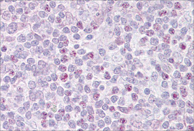 Anti-EBF1, (N-terminal) antibody produced in rabbit