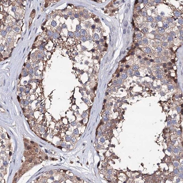 Anti-EDC3 antibody produced in rabbit