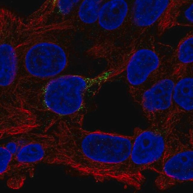 Anti-ECHDC1 antibody produced in rabbit