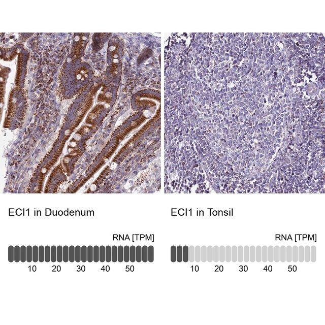 Anti-ECI1 antibody produced in rabbit