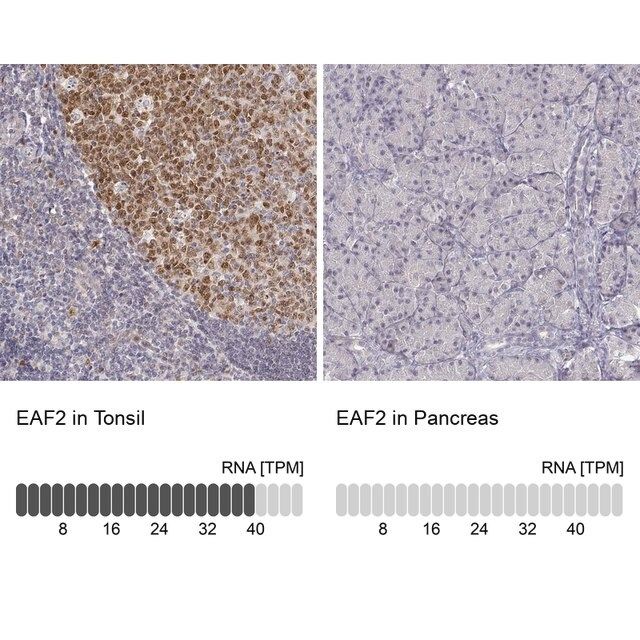 Anti-EAF2 antibody produced in rabbit