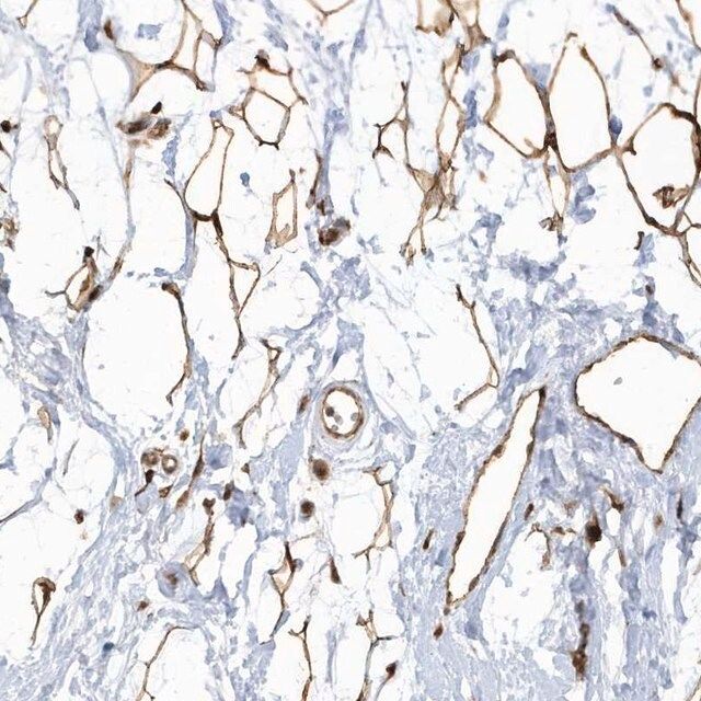 Anti-ECM2 antibody produced in rabbit