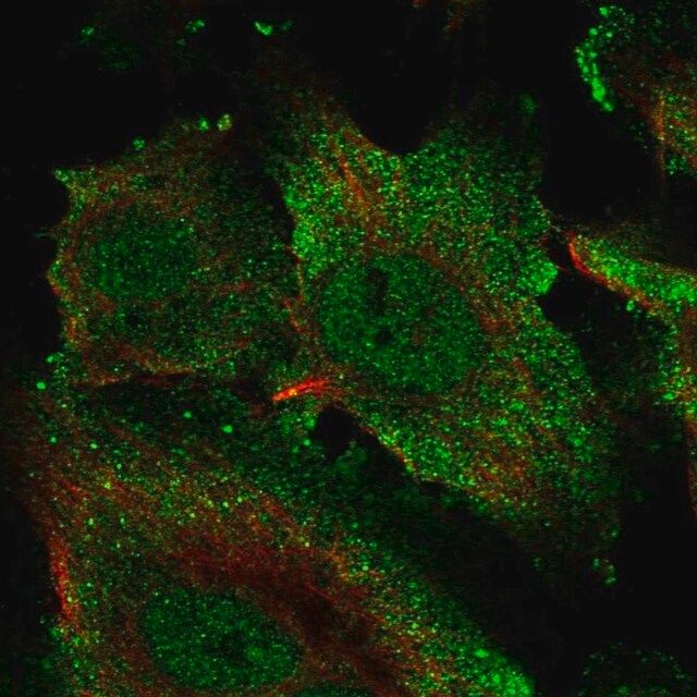 Anti-ECSCR antibody produced in rabbit