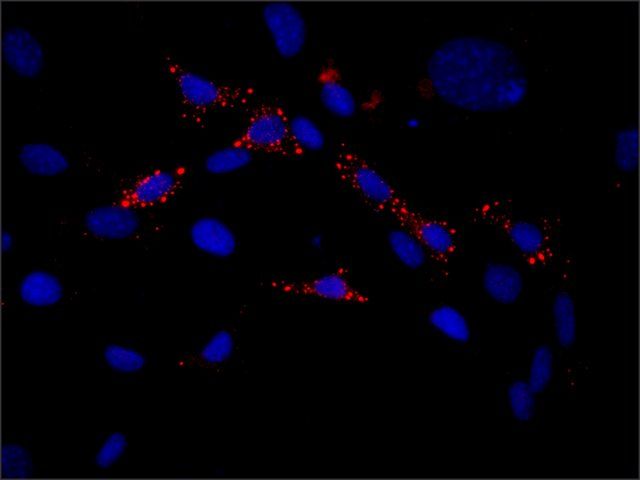 Anti-EDC4 (N-terminal) antibody produced in rabbit