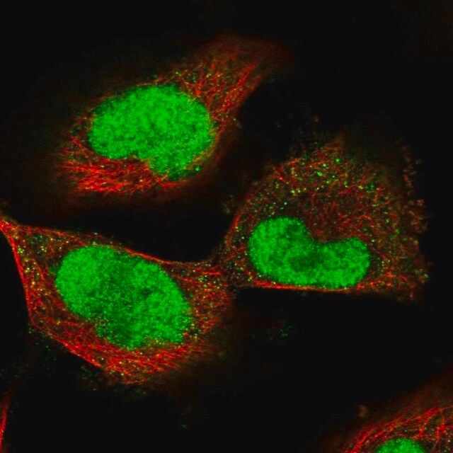 Anti-ECT2 antibody produced in rabbit