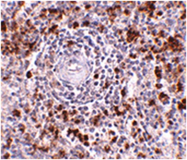 Anti-EBI3 Antibody