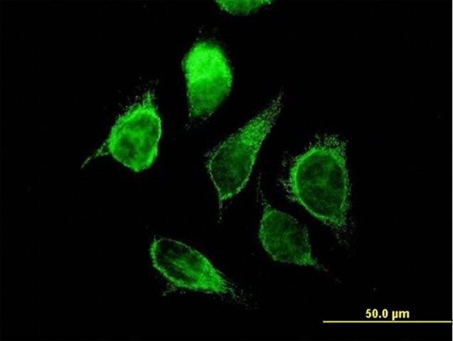 Anti-ECHS1 antibody produced in mouse