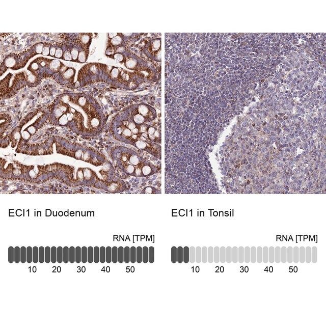 Anti-ECI1 antibody produced in rabbit