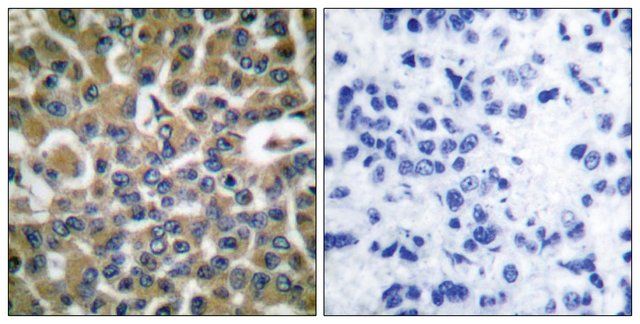 Anti-EEF2 antibody produced in rabbit