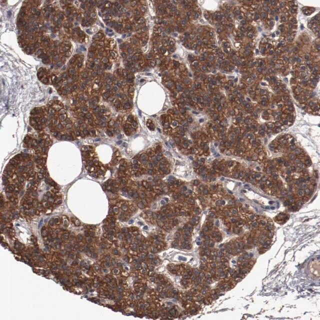 Anti-DNAAF2 antibody produced in rabbit