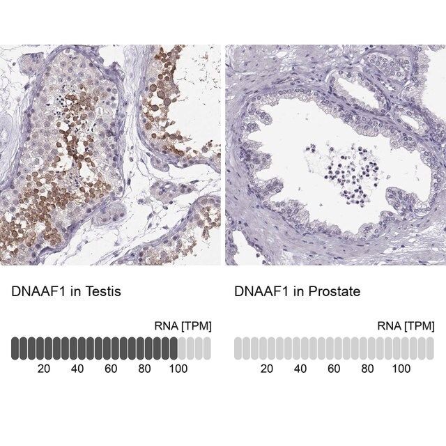 Anti-DNAAF1