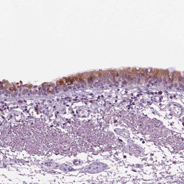 Anti-DNAH11 antibody produced in rabbit