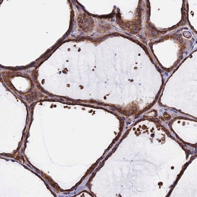 Anti-DNAJC3 antibody produced in rabbit