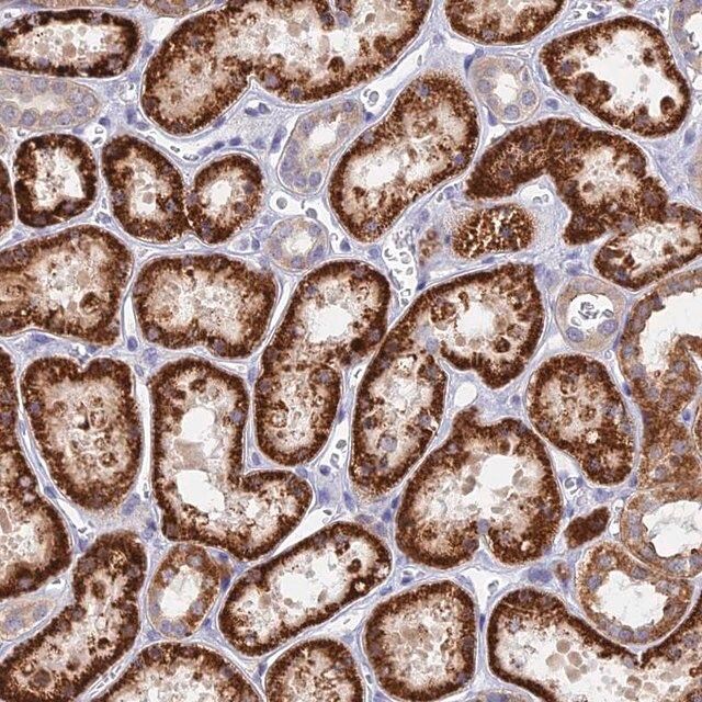 Anti-DNAJC16 antibody produced in rabbit