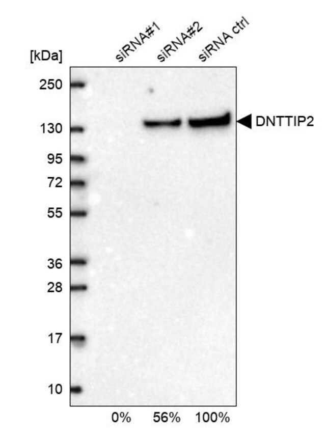 Anti-DNTTIP2 antibody produced in rabbit