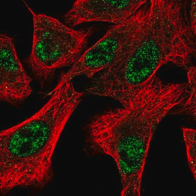 Anti-DOCK1 antibody produced in rabbit