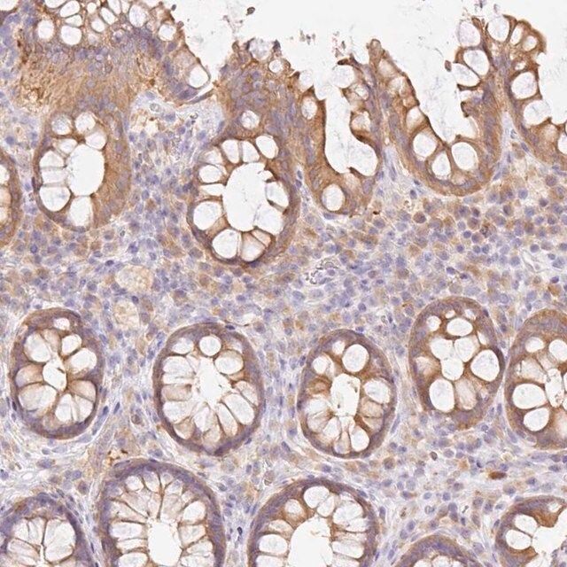 Anti-DENND5A antibody produced in rabbit