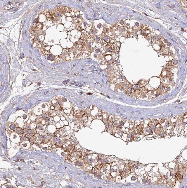 Anti-DENND5B antibody produced in rabbit