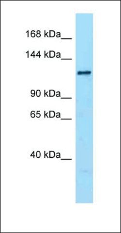 Anti-DENND1A antibody produced in rabbit