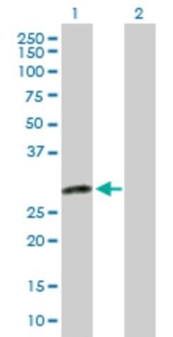 Anti-DENR antibody produced in rabbit