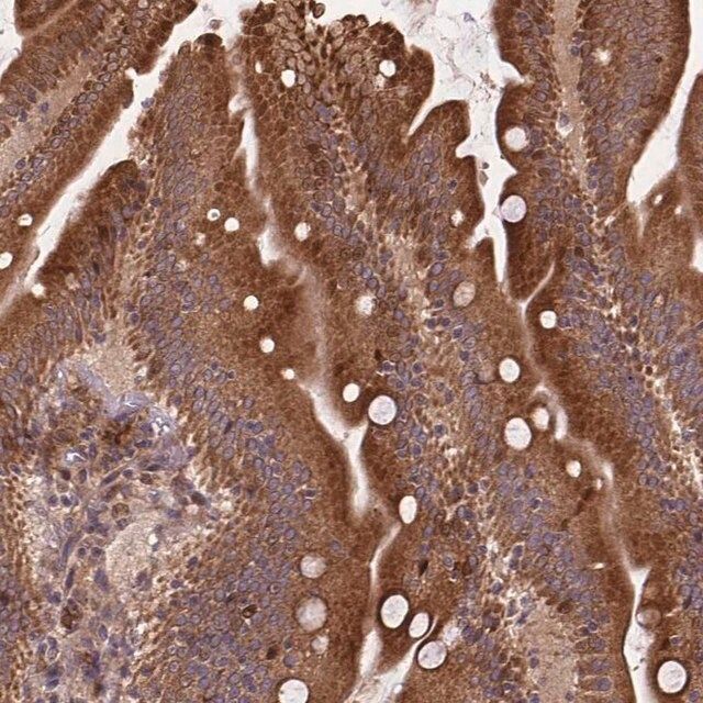 Anti-DENND6A antibody produced in rabbit