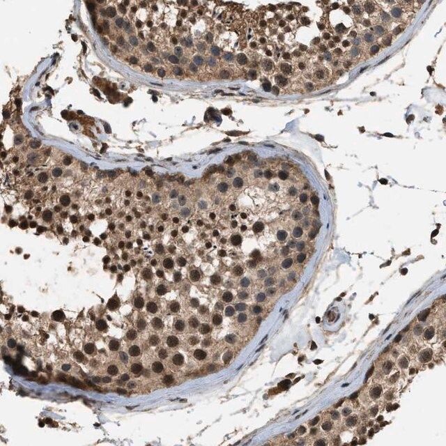 Anti-DENND6B antibody produced in rabbit