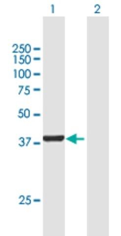 Anti-DENND1B antibody produced in mouse