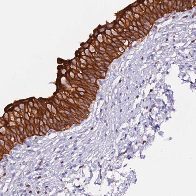 Anti-DENND2D antibody produced in rabbit