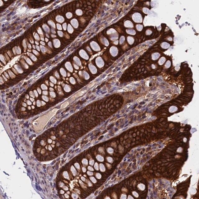 Anti-DENND1B antibody produced in rabbit