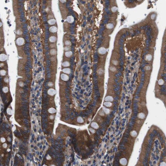 Anti-DENND4C antibody produced in rabbit