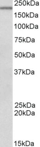 Anti-Dennd4c antibody produced in goat