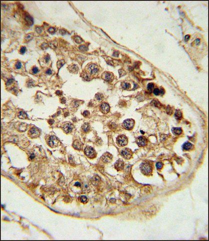 ANTI-DEPDC1 (N-TERM) antibody produced in rabbit