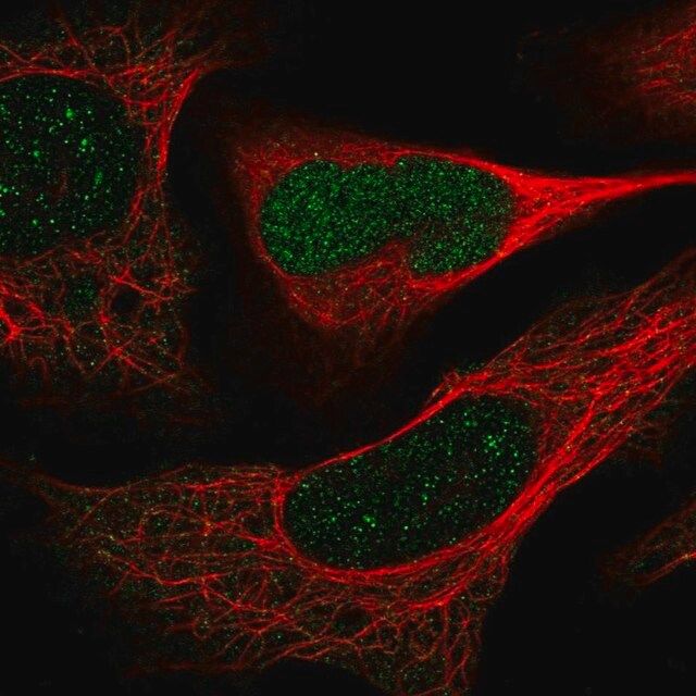 Anti-DERA antibody produced in rabbit