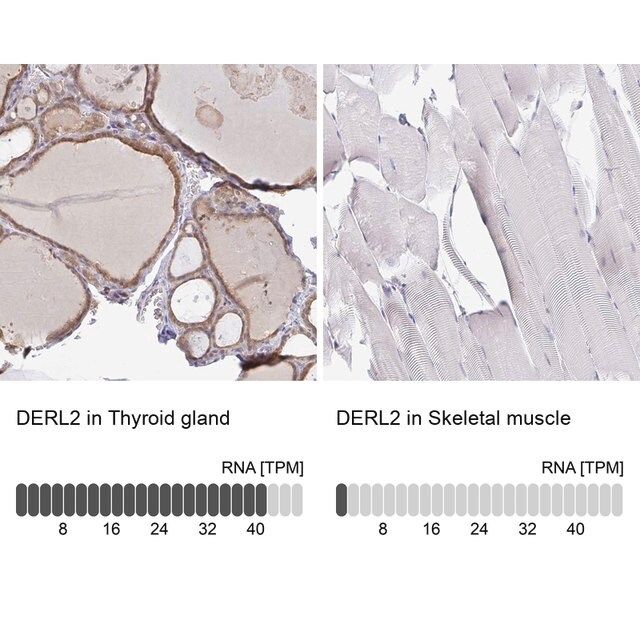 Anti-DERL2 antibody produced in rabbit