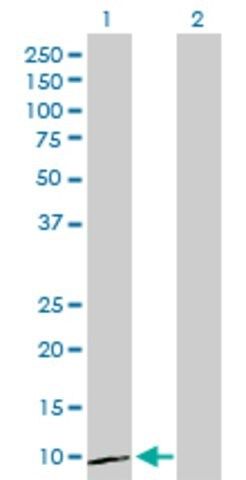 Anti-CXCL1 antibody produced in rabbit