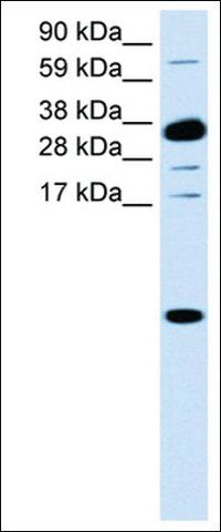 Anti-CXCL1 antibody produced in rabbit