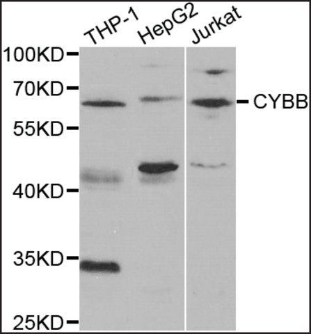 Anti-CYBB antibody produced in rabbit