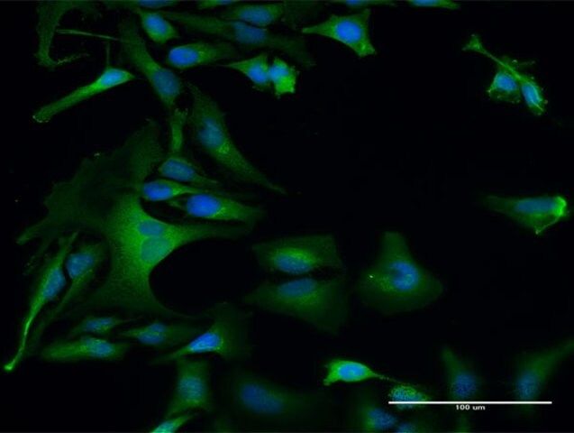 Anti-DAP3 antibody produced in rabbit