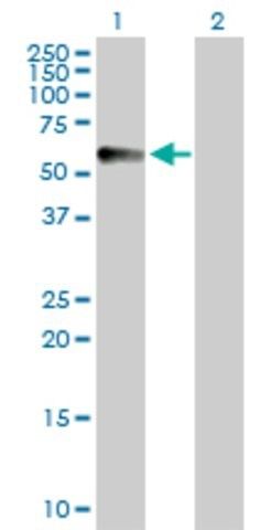 Anti-CPVL antibody produced in rabbit