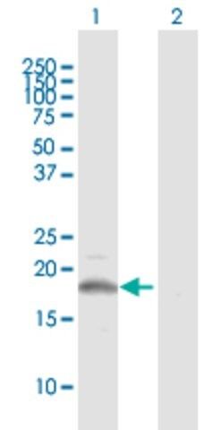 Anti-CSF3 antibody produced in mouse