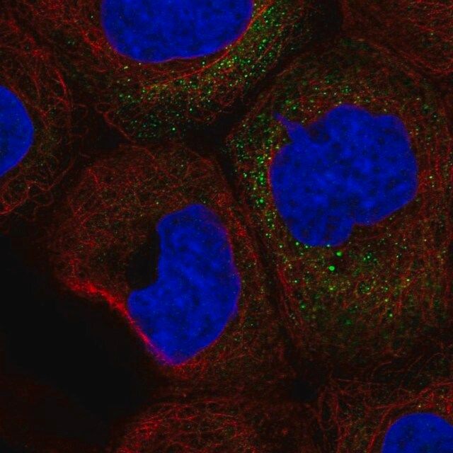 Anti-CSF2 antibody produced in rabbit